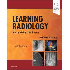 Learning Radiology Recognizing The Basics 4/E (PB)