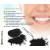 SoNatural - Activated Charcoal Powder - Teeth Whitening- Detox - Food Grade Teeth Whitening - 50G