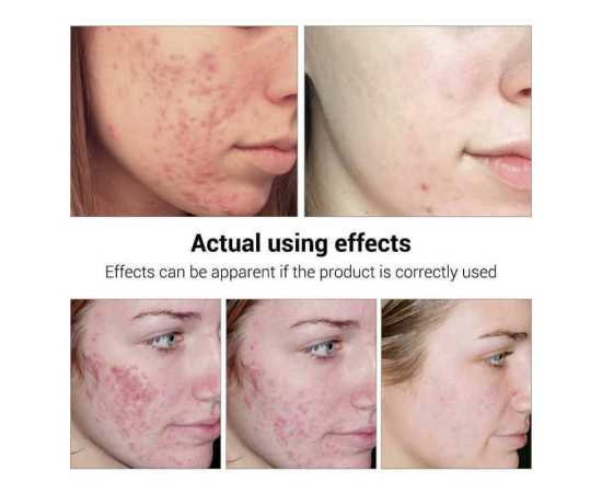 ROREC White Rice Skin Beauty Serum