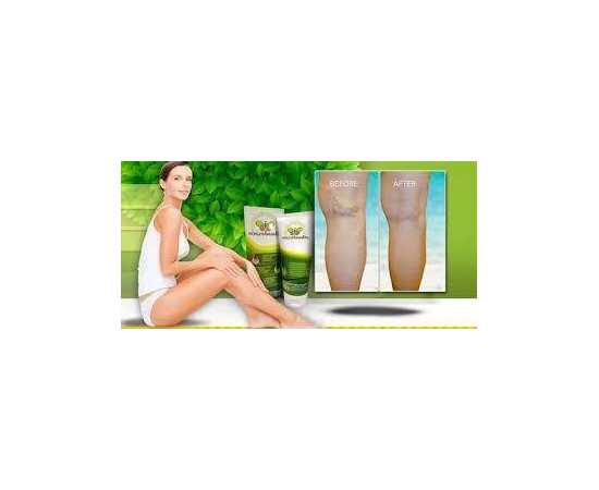 VARICOBOOSTER - VARICO'S TREATMENT