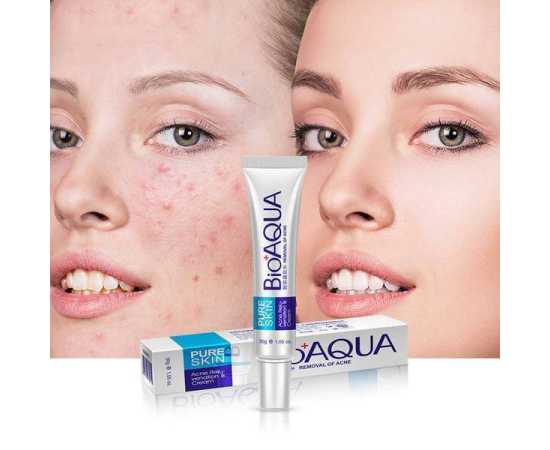 Bioaqua Pure Skin Face Care Acne Removal Cream Acne Treatment