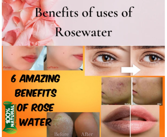 Zain Herbals Rose Water Skin Care - 800Ml Zain Herbals Rose Water Skin Care - 800Ml
