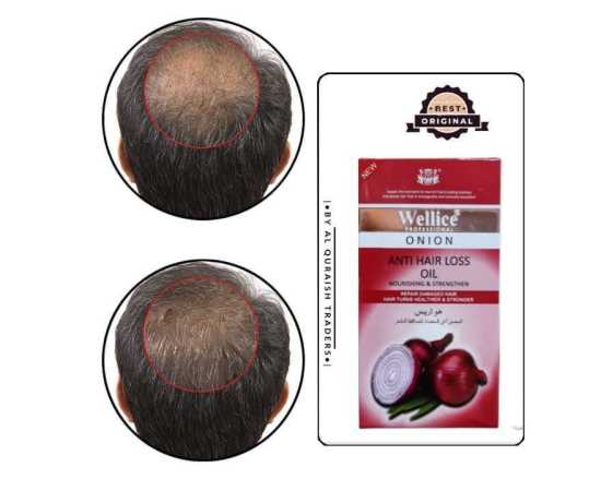 Wellice Onion Oil Anti Hairfall  - 150g