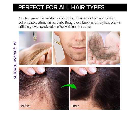 Wellice Onion Oil Anti Hairfall  - 150g