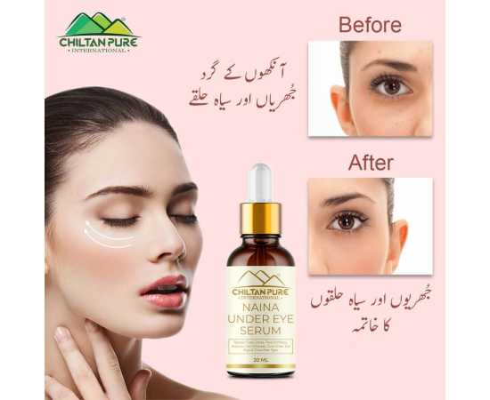 Chiltan Pure Naina Under Eye Serum For Firm Delicate SkinChiltan Pure Naina Under Eye Serum For Firm Delicate Skin