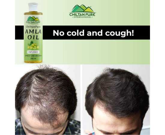 Chiltan Pure Amla Oil - Boosts Hair Growth