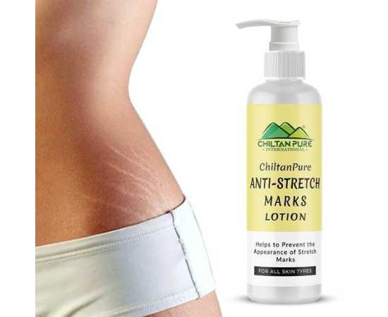 Chiltan Pure Anti-Stretch Marks Lotion - 150ML