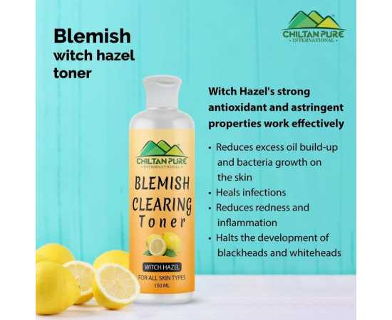 Chiltan Pure Blemish Clearing Toner - Fights With Acne For All Skin Types - 150ML