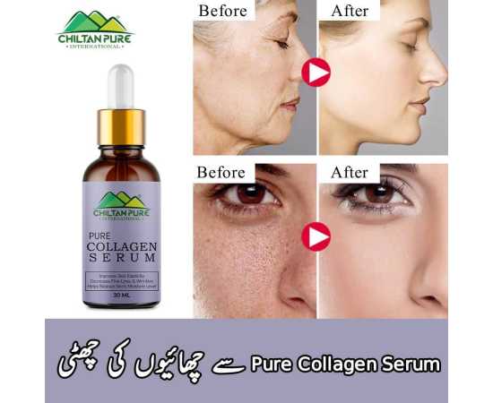 Chiltan Pure Collagen Serum - For Skin Tightening & Makes Skin Smoother