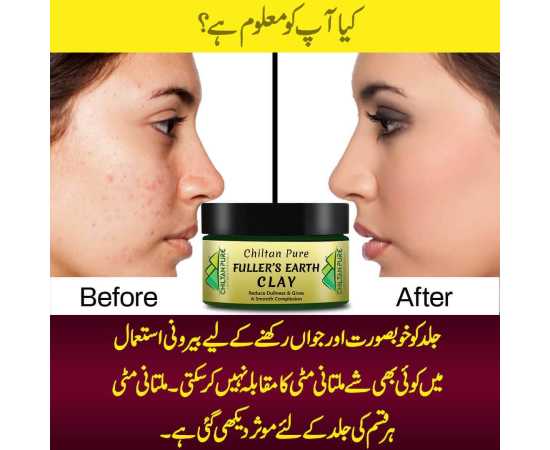 Chiltan Pure Fuller's Earth Clay - Multani Mitti For Oily Skin - 250G