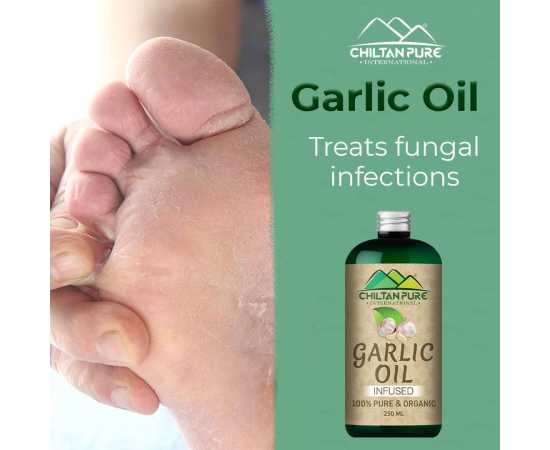 Chiltan Pure Garlic Oil - Prefect For Daily Cooking & Healthy Routine - 250ML