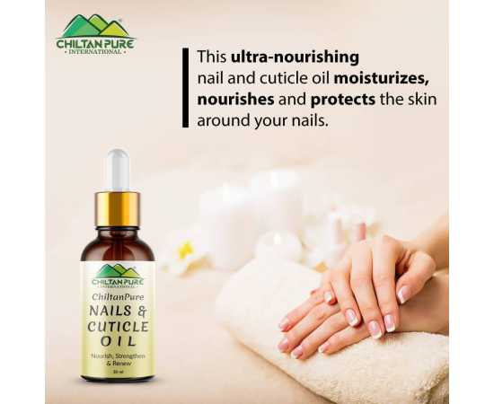 Chiltan Pure Nails & Cuticle Oil - Moisturizes & Strengthen Nails