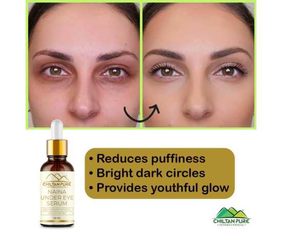 Chiltan Pure Naina Under Eye Serum For Firm Delicate Skin