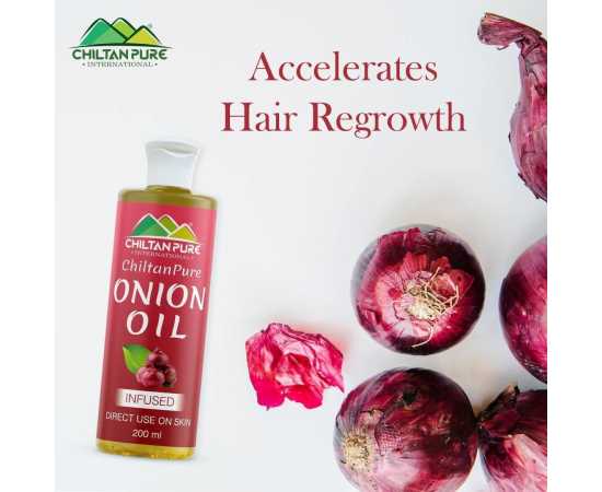 Chiltan Pure Red Onion Oil For Reduces Hair Fall