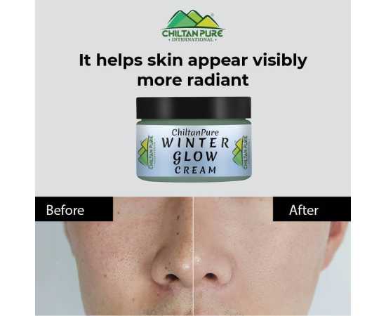 Chiltan Pure Winter Glow Cream For Dry & Dehydrated Skin