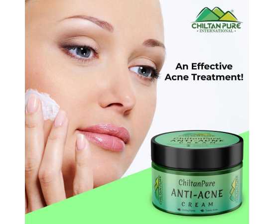 Anti-Acne Cream - Brightens Skin & Lighten Acne Scars