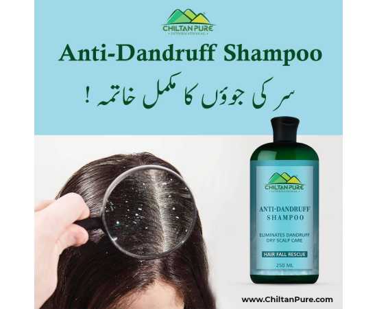 Anti Dandruff Shampoo For Strengthens Hair