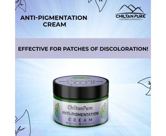 Anti-Pigmentation Cream - Brightens Skin & Fade Freckles