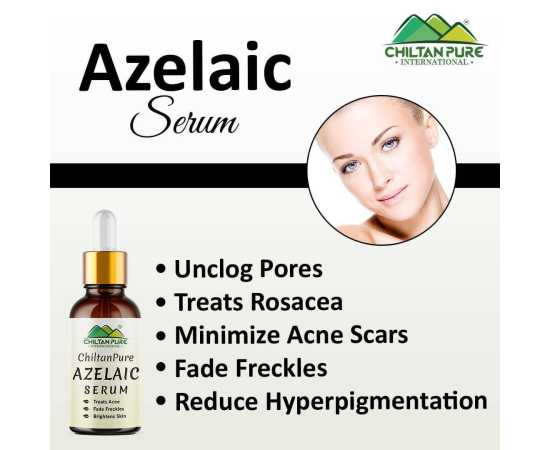 Azelaic Serum - Brightens Skin & Treats Acne