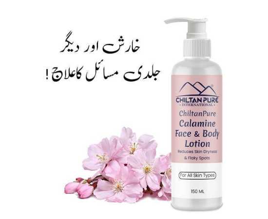 Calamine Lotion - Solution To Every Allergy - 150ML