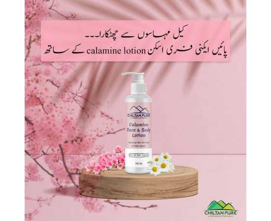 Calamine Lotion - Solution To Every Allergy - 150ML