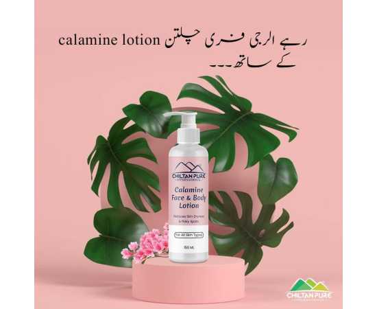 Calamine Lotion - Solution To Every Allergy - 150ML