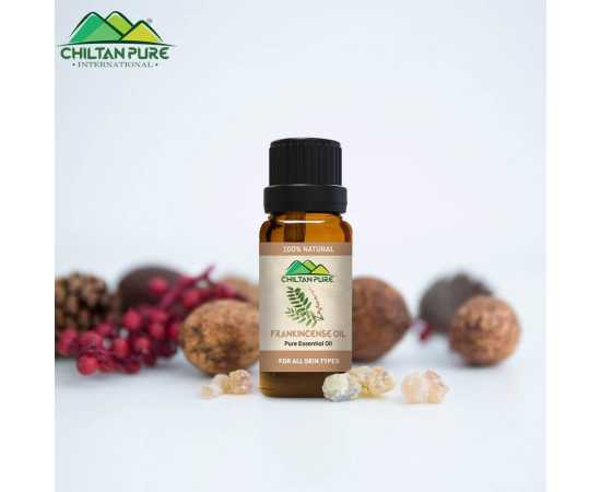 Frankincense Essential Oil - For Removing Dark Circles - 20ML