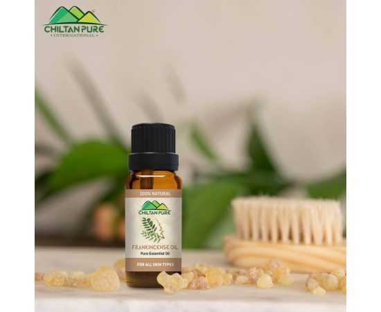 Frankincense Essential Oil - For Removing Dark Circles - 20ML