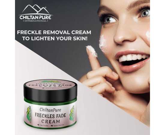 Freckles Fade Cream - Hydrates Skin & Reduce Blemishes
