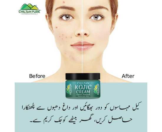 Chiltan Pure Kojic Body Lotion