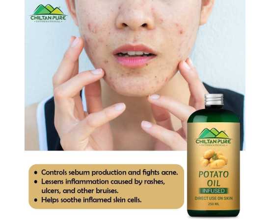 Potato Oil - Diminishes Puffiness