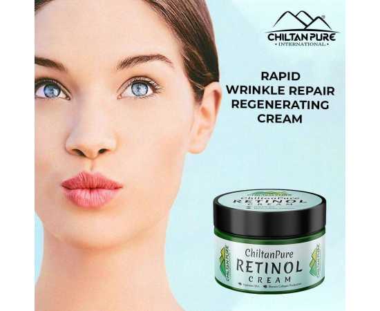 Retinol Cream - Hydrates Skin & Treats Severe Acne