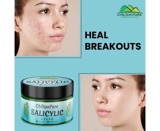 Salicylic Cream  - Exfoliates Skin & Lighten Acne Scars