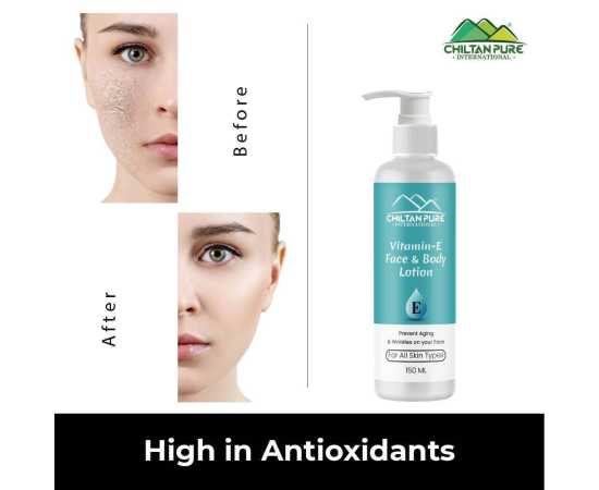 Vitamin-E Lotion - Used As A Moisturizer