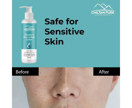 Vitamin-E Lotion - Used As A Moisturizer