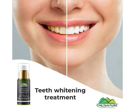 Activated Charcoal Teeth Whitening Treatment