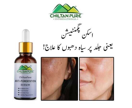 Chiltan Pure Anti-Pigmentation Serum For Brighten Skin - 30ML