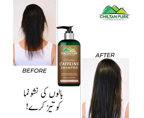 Caffeine Shampoo - Stimulate Hair Growth,- 250ML