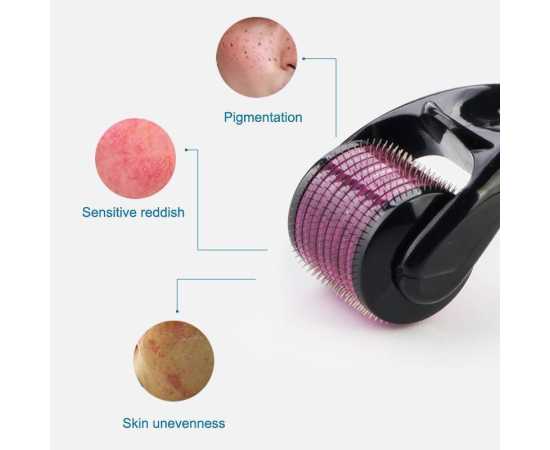 Skin Therapy 0.5 Derma Roller With 540 Micro Needle
