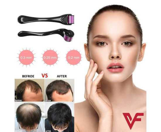 Skin Therapy 0.5 Derma Roller With 540 Micro Needle