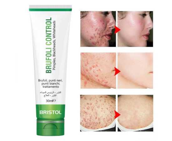 Brufoli Skin Cream For Control Blackheads & Whiteheads - 30ML