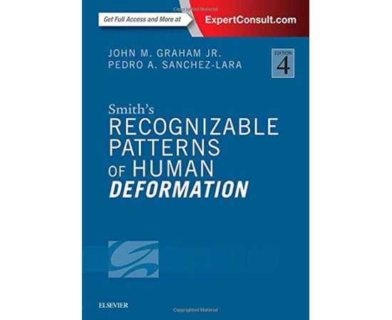 Smiths Recognizable Patterns Of Human Deformation 4/E (HB)