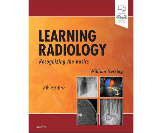 Learning Radiology Recognizing The Basics 4/E (PB)