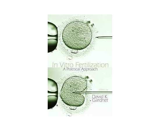 In Vitro Fertilization A Practical Approach (HB)