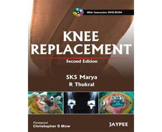 Knee Replacement 2/E + Cd (HB)