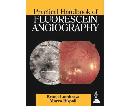 Practical Handbook Of Fluorescein Angiography (PB)