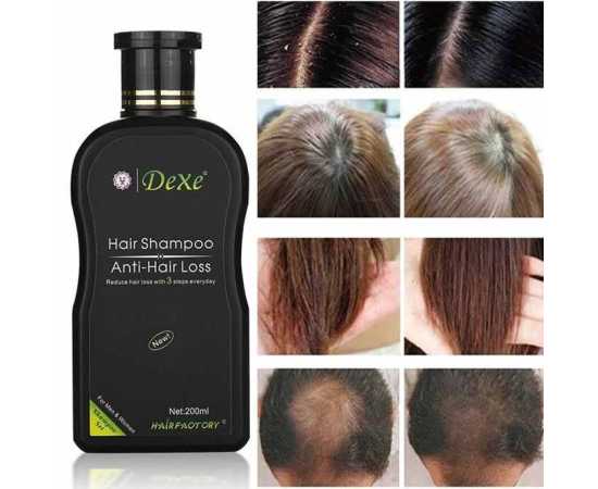 Dexe Anti Hair Loss Shampoo 200 ML